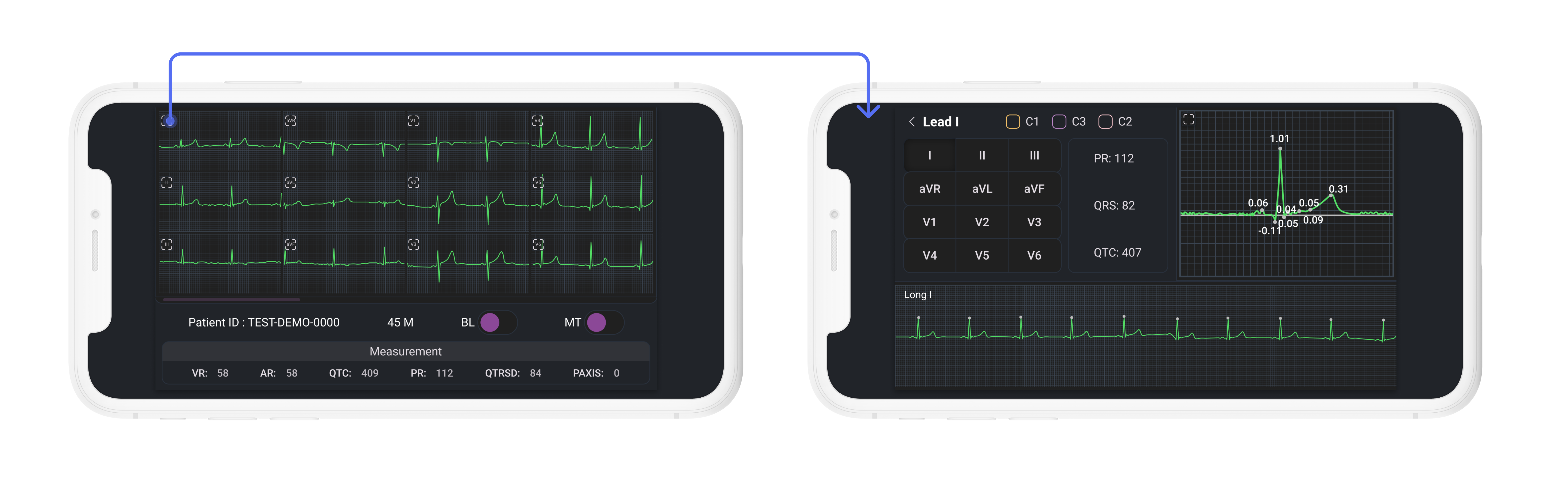 ECG Viewer Flow