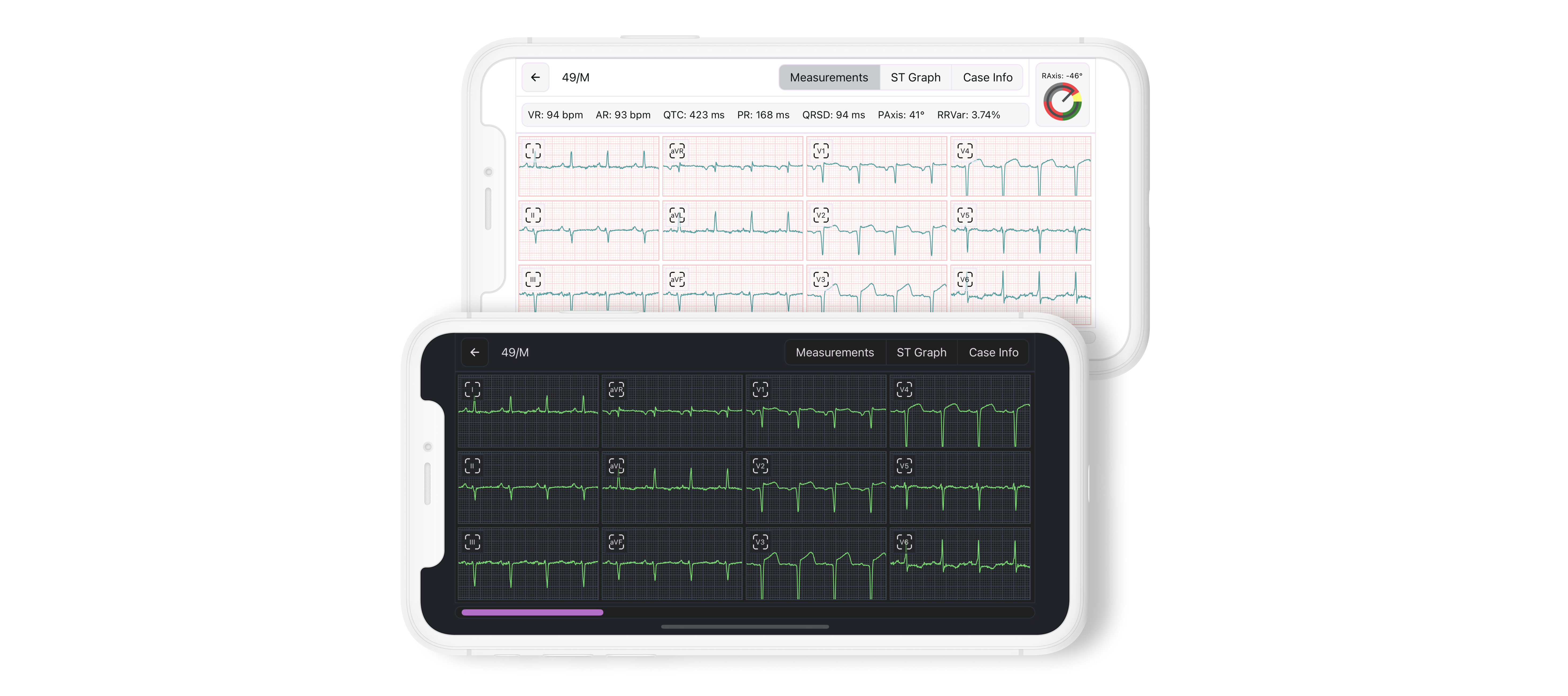 Tested ECG Viewer Screen