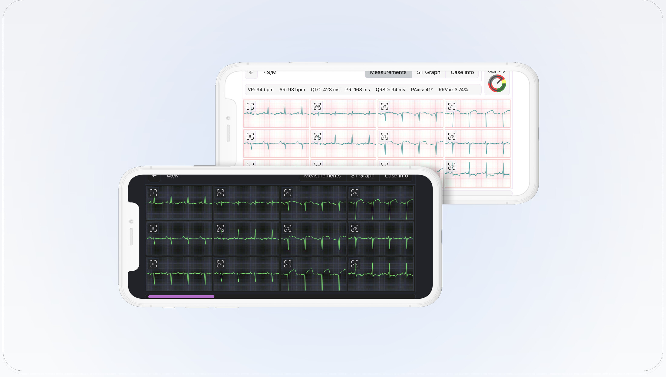 ECG Viewer